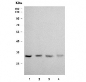 Western blot testing of human 1) PC-3, 2) Caco-2, 3) MCF7 and 4) HaCaT cell lysate with TRMT61A/tRNA methyltransferase 61A antibody. Predicted molecular weight ~31 kDa.