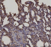 IHC staining of FFPE rat lung tissue with AGER antibody. HIER: boil tissue sections in pH8 EDTA for 20 min and allow to cool before testing.