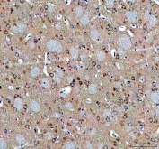 IHC staining of FFPE rat brain tissue with Abelson interactor 2 antibody. HIER: boil tissue sections in pH8 EDTA for 20 min and allow to cool before testing.