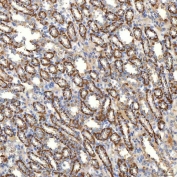 IHC staining of FFPE mouse kidney tissue with SLC20A1 antibody. HIER: boil tissue sections in pH8 EDTA for 20 min and allow to cool before testing.