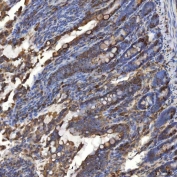 IHC staining of FFPE rat colon tissue with TXNDC5 antibody. HIER: boil tissue sections in pH8 EDTA for 20 min and allow to cool before testing.