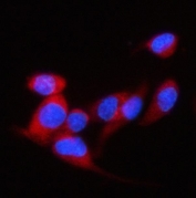 Immunofluorescent staining of FFPE human EIF4G2 cells with DAP5 antibody (red) and DAPI nuclear stain (blue). HIER: steam section in pH6 citrate buffer for 20 min.