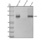 Immunoprecipitation of Thrombomodulin protein from 500ug of human A431 whole cell lysate with 2ug of Thrombomodulin antibody.