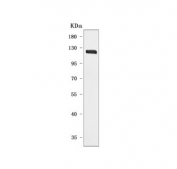 Western blot testing of human SH-SY5Y cell lysate with DBL antibody. Predicted molecular weight: 96-116 kDa (multiple isoforms).
