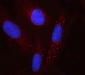 Immunofluorescent staining of FFPE human U-2 OS cells with GCM1 antibody (red) and DAPI nuclear stain (blue). HIER: steam section in pH6 citrate buffer for 20 min.