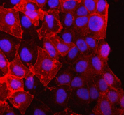 Immunofluorescent staining of FFPE human Caco-2 cells with PKP2 antibody (red) and DAPI nuclear stain (blue). HIER: steam section in pH6 citrate buffer for 20 min.