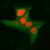 Immunofluorescence analysis of RNF34 and Tubulin beta in human A549 cells. RNF34 antibody (red) staining shows predominant nuclear localization with punctate signal distributed within the nucleus, accompanied by weaker punctate staining in the cytoplasm. Tubulin beta antibody (green) highlights the cytoplasmic microtubule network, providing contrast to the nuclear RNF34 signal. Cells were fixed and blocked prior to incubation with rabbit anti-RNF34 antibody and mouse anti-Tubulin beta antibody, followed by Cy3-conjugated goat anti-rabbit IgG (red) and DyLight 488-conjugated goat anti-mouse IgG (green). Images were acquired using a fluorescence microscope with appropriate filter sets.
