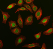 Immunofluorescence analysis of ROCK1 expression in SiHa cells. Human SiHa cells were stained with anti-ROCK1 antibody (green) and anti-Alpha Tubulin antibody (red), followed by fluorophore-conjugated secondary antibodies. ROCK1 signal is observed prominently in the nuclear region with additional cytoplasmic staining, while Alpha Tubulin labels the cytoplasmic microtubule network. Although ROCK1 is classically described as a cytoplasmic kinase associated with actin and membrane-linked structures, nuclear localization has been reported in the literature under specific cellular contexts, consistent with the staining pattern observed here.
