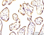 IHC staining of FFPE placental tissue with RPL11 antibody. HIER: boil tissue sections in pH8 EDTA for 20 min and allow to cool before testing.
