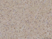 TMEM87A Antibody Mouse Brain IHC. Immunohistochemical staining of FFPE mouse brain tissue using TMEM87A Antibody / Transmembrane Protein 87A Antibody. Heat-induced epitope retrieval was performed using pH8 EDTA buffer, followed by HRP-conjugated secondary antibody detection and DAB chromogen. Diffuse cytoplasmic and membranous staining is observed throughout the brain parenchyma, consistent with TMEM87A expression in neural tissue. This TMEM87A Antibody, also called Transmembrane Protein 87A Antibody, is suitable for studies of membrane protein expression, intracellular trafficking, neurobiology, and cellular signaling.