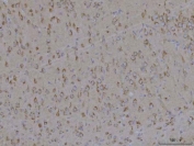 TMEM87A Antibody Rat Brain IHC. Immunohistochemical staining of FFPE rat brain tissue using TMEM87A Antibody / Transmembrane Protein 87A Antibody. Heat-induced epitope retrieval was performed using pH8 EDTA buffer, followed by HRP-conjugated secondary antibody detection and DAB chromogen. Moderate cytoplasmic and membranous staining is observed throughout the brain parenchyma, consistent with TMEM87A expression in neural tissue. This TMEM87A Antibody, also called Transmembrane Protein 87A Antibody, is suitable for studies of membrane protein expression, intracellular trafficking, neurobiology, and cellular signaling.