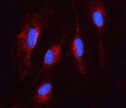TMEM87A Antibody U-87 MG Cell IF. Immunofluorescent staining of FFPE human U-87 MG cells using TMEM87A Antibody / Transmembrane Protein 87A Antibody. Heat-induced epitope retrieval was performed by steaming sections in pH6 citrate buffer for 20 minutes. TMEM87A immunoreactivity (red) is observed predominantly within the cytoplasm with membranous accentuation, while DAPI (blue) counterstains the nuclei. This TMEM87A Antibody, also called Transmembrane Protein 87A Antibody, is suitable for studies of membrane protein expression, intracellular trafficking, cellular signaling, and protein localization by immunofluorescence microscopy.