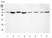 TMEM87A Antibody Human, Rat and Mouse WB. Western blot analysis of lane 1: human T-47D, lane 2: human MDA-MB-453, lane 3: human PC-3, lane 4: human MCF7, lane 5: rat brain, lane 6: rat PC-12, lane 7: mouse brain, and lane 8: mouse RAW264.7 cell lysates using TMEM87A Antibody / Transmembrane Protein 87A Antibody. A specific band is detected at approximately 63 kDa, with the slightly higher apparent molecular weight consistent with glycosylation of TMEM87A. This TMEM87A Antibody, also called Transmembrane Protein 87A Antibody, is suitable for studies of membrane protein expression, intracellular trafficking, cellular signaling, and membrane protein biology across multiple species.