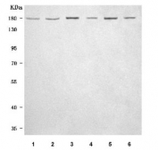 PDGFR Alpha Antibody Human Mouse Rat Brain WB. Western blot analysis of human 293T (lane 1), human U-251 (lane 2), rat brain (lane 3), rat C6 (lane 4), mouse brain (lane 5), and mouse NIH 3T3 (lane 6) lysates using PDGFR Alpha Antibody / Receptor Tyrosine Kinase Antibody demonstrates strong immunoreactive bands at approximately 180 kDa. PDGFRA is a cell-surface receptor tyrosine kinase that mediates platelet-derived growth factor signaling and regulates cellular proliferation, migration, differentiation, and survival. The observed molecular weight is consistent with mature glycosylated PDGFRA protein, which commonly migrates at substantially higher molecular weights than its predicted core protein size due to extensive post-translational glycosylation. The broad reactivity observed across human, rat, and mouse samples supports conserved expression of PDGFRA in neural and mesenchymal cell populations. Expected molecular weight: 120-195 kDa depending on glycosylation level.