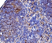 CD38 Antibody mouse lymph node tissue IHC. Immunohistochemistry analysis of Cd38 / plasma cell marker expression in FFPE mouse lymph node tissue using a CD38 antibody. Strong membranous and cytoplasmic HRP-DAB brown staining highlights lymphocyte populations within cortical and paracortical regions, with prominent signal in immune cell-rich compartments and scattered intensely positive cells consistent with activated lymphocytes. The staining pattern demonstrates conserved Cd38 expression across mouse lymphoid tissue with clear contrast against surrounding negative stromal elements. HIER was performed by boiling tissue sections in pH 8 EDTA buffer for 20 minutes followed by cooling prior to antibody incubation.
