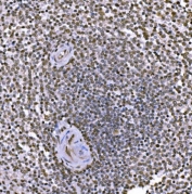 JUN Antibody Human Spleen IHC. Immunohistochemical staining of FFPE human spleen tissue using JUN Antibody demonstrates widespread nuclear HRP-DAB brown staining throughout splenic cellular populations, with particularly prominent staining surrounding lymphoid follicles. The staining pattern is consistent with expression of JUN (c-Jun), a DNA-binding component of the AP-1 transcription factor complex that regulates gene expression involved in immune responses, cellular activation, differentiation, and stress-responsive signaling pathways. The predominantly nuclear localization is characteristic of a transcription factor and supports the role of JUN in coordinating transcriptional programs within immune-associated tissues. HIER: boil tissue sections in pH 8 EDTA buffer for 20 minutes and allow to cool before testing.