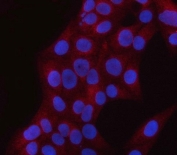 PNPLA6 Antibody for IF. Immunofluorescence analysis in human U-2 OS cells. FFPE human U-2 OS cells stained with PNPLA6 antibody (red) show predominantly cytoplasmic staining, consistent with its role as a membrane-associated phospholipase. Nuclei are counterstained with DAPI (blue). Antigen retrieval was performed using pH6 citrate buffer with heat-induced epitope retrieval prior to staining.