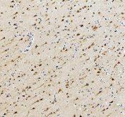 PNPLA6 Antibody for IHC. Immunohistochemistry analysis in human brain tissue. FFPE human brain tissue stained with PNPLA6 antibody shows cytoplasmic staining in neuronal cell bodies and processes, consistent with its role in phospholipid metabolism and neuronal maintenance. Detection was performed using an HRP-conjugated secondary antibody with DAB chromogen (brown), and nuclei are counterstained with hematoxylin (blue). Antigen retrieval was carried out using pH8 EDTA buffer with heat-induced epitope retrieval prior to staining.
