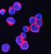 CD3 Gamma Antibody Human JK Cell IF. Immunofluorescent staining of FFPE human JK cells with CD3 gamma antibody (red). Heat-induced epitope retrieval (HIER) was performed by steaming sections in pH 6 citrate buffer for 20 minutes prior to staining. Nuclei are counterstained with DAPI (blue). CD3 gamma immunoreactivity is observed predominantly along the cell membrane, consistent with the expected localization of this T-cell receptor complex protein involved in antigen recognition and T-cell activation.
