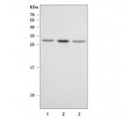 Western blot testing of human 1) HepG2, 2) A431 and 3) PC-3 cell lysate with PRRG1/TMG1 antibody. Predicted molecular weight ~25 kDa.