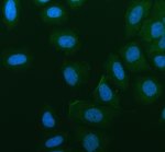 PRRG1 Antibody by IF in human SiHa cells. Immunofluorescence staining of human SiHa cells using PRRG1 Antibody at 5 ug/ml. Green fluorescence indicates PRRG1 immunoreactivity, while DAPI counterstaining identifies nuclei in blue. The image shows relatively weak, diffuse green staining in the extranuclear cellular regions, with occasional brighter peripheral and punctate signals. Nuclear regions exhibit little green fluorescence. The distribution is compatible with an extranuclear protein, although a distinct plasma membrane localization cannot be established from this image alone. Cells underwent enzymatic antigen retrieval and overnight primary antibody incubation at 4oC, followed by a Fluoro488-conjugated secondary antibody. This TMG1 Polyclonal Antibody provides an additional means of examining PRRG1 localization.