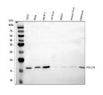 POLR2H Antibody Human, Rat and Mouse WB. Western blot testing of human 293T, HeLa and MCF-7 cell lysates, rat liver tissue lysate, rat RH35 cell lysate, mouse liver tissue lysate and mouse HEPA1-6 cell lysate with POLR2H Antibody at 0.5 ug/ml. Lane 1: human 293T; Lane 2: human HeLa; Lane 3: human MCF-7; Lane 4: rat liver; Lane 5: rat RH35; Lane 6: mouse liver; Lane 7: mouse HEPA1-6. A specific band was detected at approximately 17 kDa, consistent with the predicted molecular weight. POLR2H Antibody / RNA Polymerase II Subunit Antibody detects endogenous RNA Polymerase II Subunit H expression and supports studies of transcription machinery, gene expression regulation and RNA polymerase complex function.