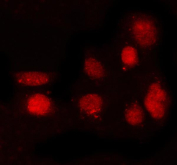 Immunofluorescent staining of FFPE human PC-3 cells with PRDM8 antibody (red). HIER: steam section in pH6 citrate buffer for 20 min.