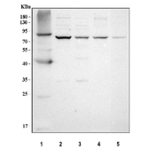 Western blot analysis using PRDM8 antibody. Lane 1: human HT1080 whole cell lysates; Lane 2: human MCF-7 whole cell lysates; Lane 3: human SH-SY5Y whole cell lysates; Lane 4: rat brain tissue lysates; Lane 5: mouse brain tissue lysates. The predicted molecular weight of PRDM8 is ~72 kDa, and a band is observed at the expected size. In HT1080 cells, PRDM8 migrates slightly higher, consistent with cell-type-dependent modification or isoform variation.