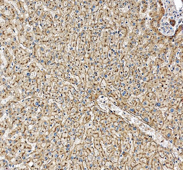 Apolipoprotein E Antibody Human Liver IHC. Immunohistochemical staining of FFPE human liver tissue with Apolipoprotein E antibody at 2 ug/ml. Heat-induced epitope retrieval (HIER) was performed by boiling tissue sections in pH 8 EDTA buffer prior to staining. Apolipoprotein E immunoreactivity is observed predominantly within the cytoplasm and along the cell membranes of hepatocytes, consistent with the expected localization of this lipid transport protein involved in cholesterol homeostasis and lipoprotein metabolism. Cell nuclei are counterstained with hematoxylin (blue).