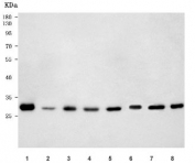 PSME1 Antibody Human, Rat and Mouse WB. Western blot testing of 1) human Raji, 2) human A431, 3) rat liver, 4) rat spleen, 5) rat RH35, 6) mouse liver, 7) mouse spleen, and 8) mouse RAW264.7 lysates with PSME1 antibody. A distinct immunoreactive band is detected at approximately 29 kDa in all samples, consistent with the predicted molecular weight of PSME1. The results demonstrate specific detection of this immunoproteasome activator, which promotes proteasome-mediated antigen processing and generation of peptides for Major Histocompatibility Complex class I presentation.