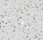 Liprin alpha 2 Antibody Human Brain IHC. Immunohistochemistry analysis of FFPE human brain tissue using Liprin alpha 2 Antibody / Synaptic Scaffold Protein Antibody. Heat mediated antigen retrieval was performed using pH 8 EDTA buffer, and the tissue section was incubated with the primary antibody at 2 ug/ml overnight at 4Â°C. HRP-conjugated secondary antibody and DAB substrate were used for detection. Cytoplasmic staining is observed in neuronal cells, supporting the use of Liprin alpha 2 Antibody / Synaptic Scaffold Protein Antibody for studying synaptic scaffold protein expression, neuronal signaling and presynaptic organization pathways.