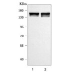 Liprin alpha 2 Antibody Rat and Mouse Brain WB. Western blot analysis of rat brain and mouse brain tissue lysates using Liprin alpha 2 Antibody / Synaptic Scaffold Protein Antibody. Lane 1: rat brain; Lane 2: mouse brain. A specific band is detected at approximately 143 kDa, consistent with the predicted molecular weight of Liprin alpha 2. These results support the use of Liprin alpha 2 Antibody / Synaptic Scaffold Protein Antibody for studying synaptic scaffold protein expression, presynaptic organization and neuronal signaling pathways in brain tissue.
