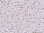 Liprin alpha 2 Antibody Rat Brain IHC. Immunohistochemistry analysis of FFPE rat brain tissue using Liprin alpha 2 Antibody / Synaptic Scaffold Protein Antibody. Heat induced antigen retrieval was performed by boiling tissue sections in pH 8 EDTA buffer for 20 minutes prior to staining. Cytoplasmic and neuronal staining is observed within brain tissue, consistent with the role of Liprin alpha 2 in synaptic organization and neuronal signaling. These results support the use of Liprin alpha 2 Antibody / Synaptic Scaffold Protein Antibody for studying synaptic scaffold proteins, presynaptic regulation and nervous system function.