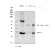 Immunoprecipitation of PSMD14 protein from 500ug of human HeLa whole cell lysate with 2ug of PSMD14 antibody.