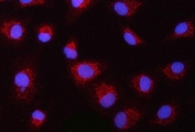 PYCARD Antibody / Inflammasome Adaptor Protein Antibody A549 Cell IF. Immunofluorescent staining of FFPE human A549 cells using PYCARD Antibody / Inflammasome Adaptor Protein Antibody (red) with DAPI nuclear counterstain (blue). PYCARD expression is observed predominantly within the cytoplasm, consistent with its role as an inflammasome adaptor protein that mediates innate immune signaling, ASC speck formation, and inflammatory caspase activation. Heat-induced epitope retrieval was performed by steaming sections in pH 6 citrate buffer for 20 minutes prior to immunofluorescent staining.