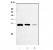 PYCARD Antibody / Inflammasome Adaptor Protein Antibody WB. Western blot analysis of human THP-1, HL-60, and A549 cell lysates using PYCARD Antibody / Inflammasome Adaptor Protein Antibody. A distinct immunoreactive band is detected at approximately 22 kDa, consistent with the predicted molecular weight of PYCARD (ASC). Strong expression is observed in THP-1 and HL-60 cells, with comparatively lower expression detected in A549 cells, supporting specific detection of endogenous PYCARD across multiple human cell lines.