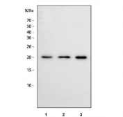Western blot testing of human 1) SH-SY5Y, 2) Caco-2 and 3) HeLa cell lysate with NHP2 antibody. Predicted molecular weight ~17 kDa, commonly observed at 17-20 kDa.
