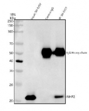 Immunoprecipitation of NHP2 protein from 500ug of human SH-SY5Y whole cell lysate with 2ug of NHP2 antibody.