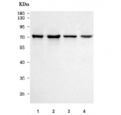 Western blot testing of human 1) SH-SY5Y, 2) MCF7, 3) HeLa and 4) A431 cell lysate with Atherin antibody. Predicted molecular weight ~56 kDa, observed here at ~70 kDa.