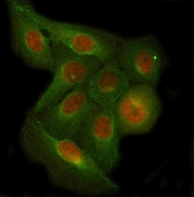 C7orf47 Antibody U-2 OS Cell IF. Immunofluorescence analysis of FFPE human U-2 OS cells using C7orf47 Antibody (PPP1R35 antibody, red) shows cytoplasmic and perinuclear staining, consistent with PPP1R35 localization as a protein phosphatase regulatory factor. Beta Tubulin mAb (green) highlights the microtubule network, providing structural context relative to the PPP1R35 signal. The distribution pattern supports association with intracellular regulatory complexes involved in phosphorylation-dependent cellular processes. HIER: steam section in pH 6 citrate buffer for 20 min.