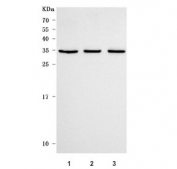 C7orf47 Antibody Human Cell Line Panel WB. Western blot analysis of human 1) Jurkat, 2) SH-SY5Y, and 3) K562 cell lysates using C7orf47 Antibody (PPP1R35 antibody) detects a band at approximately 28 kDa, consistent with the predicted molecular weight of PPP1R35 / C7orf47. The consistent banding pattern across multiple cell lines supports reliable detection of this protein phosphatase regulatory factor involved in phosphorylation-dependent cellular processes.
