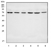 NR5A2 Antibody Multi-Cell Line WB. Western blot analysis of human HepG2, A549, Caco-2, 293T, MCF7, and K562 cell lysates using NR5A2 antibody demonstrates consistent bands near 60-65 kDa across multiple epithelial and hematopoietic-derived cell lines, corresponding to the predicted molecular weight of NR5A2 / Liver receptor homolog 1. The broad expression profile supports the established role of this orphan nuclear receptor in metabolic signaling, epithelial differentiation, and transcriptional regulatory pathways.