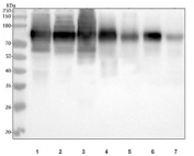 CD44 Antibody Multi-Species WB. Western blot analysis of CD44 / CD44 antigen expression using antibody. Lane 1: human U-87 MG cell lysate, Lane 2: human HeLa cell lysate, Lane 3: human PANC-1 cell lysate, Lane 4: rat spleen lysate, Lane 5: rat thymus lysate, Lane 6: mouse spleen lysate, Lane 7: mouse thymus lysate. A band is detected at approximately 80-95 kDa, consistent with the predicted molecular weight of CD44 (CD44 / CD44 antigen). CD44 is a glycosylated transmembrane protein, and the slightly diffuse band appearance reflects glycosylation-dependent variation in electrophoretic migration. The consistent detection across human, rat, and mouse samples supports CD44 expression in both epithelial and lymphoid tissues.