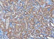 Kallikrein 7 Antibody for Rat IHC and WB immunohistochemistry analysis of KLK7 in rat kidney tissue. FFPE rat kidney tissue was stained using a rabbit polyclonal Kallikrein 7 antibody suitable for rat IHC and WB. Heat induced epitope retrieval was performed by boiling tissue sections in pH 8 EDTA buffer for 20 minutes followed by cooling prior to staining. HRP-DAB brown chromogenic signal highlights KLK7-positive epithelial structures within renal tubules, while nuclei appear blue from hematoxylin counterstain. This staining pattern demonstrates detection of Kallikrein 7 (KLK7), also known as stratum corneum chymotryptic enzyme, in rat tissue and supports use of Kallikrein 7 Antibody for Rat IHC and WB for immunohistochemistry studies in rat experimental models.