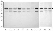 Western blot testing of 1) human HeLa, 2) human Jurkat, 3) human PC-3, 4) human 293T, 5) monkey COS-7, 6) human HEL, 7) human U-2 OS, 8) human SH-SY5Y, 9) rat C6, 10) mouse thymus and 11) mouse NIH 3T3 cell lysate with TR4 antibody. Test shows the expected full-length ~65-67 kDa band along with additional lower bands at ~50-55 kDa, consistent with N-terminally truncated TR4 isoforms generated by alternative initiation or limited proteolysis.