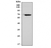 Western blot analysis of Msln antibody in mouse heart tissue lysate. A distinct band is observed at approximately 65-70 kDa, consistent with the predicted molecular weight of Mesothelin at approximately 69 kDa. Mesothelin is a glycoprotein and post-translational modification, including glycosylation, may contribute to minor apparent molecular weight variation on SDS-PAGE. This antibody is designed for mouse sample detection.