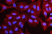 MMP19 Antibody U-2 OS Cell IF. Immunofluorescent staining of FFPE human U-2 OS cells using MMP19 antibody demonstrates prominent cytoplasmic staining (red) throughout the cell body, consistent with expression of Matrix Metalloproteinase 19 (MMP19). MMP19 is a tissue remodeling protein that regulates extracellular matrix turnover, cellular migration, and tissue organization through modification of the extracellular microenvironment. The observed staining pattern is consistent with the synthesis and intracellular trafficking of MMP19 prior to secretion and extracellular activity. DAPI nuclear stain (blue) identifies cell nuclei and provides contrast to the predominantly cytoplasmic distribution of MMP19. HIER: steam section in pH6 citrate buffer for 20 min.