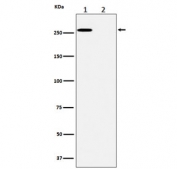 Phospho-ACACA (Ser79) Antibody for WB. Western blot analysis of ACACA / Acetyl-CoA carboxylase 1 phosphorylation in human A431 cell lysate using Phospho-ACACA (Ser79) Antibody - metabolic stress marker (clone 28A12). Lane 1: untreated lysate, Lane 2: lysate treated with lambda protein phosphatase. A band is detected at approximately 260 kDa in the untreated sample, consistent with phosphorylated ACC1, while signal is abolished following phosphatase treatment, confirming phosphorylation-dependent detection at Ser79 and supporting specificity for the inhibited form of ACC1 associated with suppressed lipogenesis.