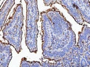 Maltase-glucoamylase Antibody Rat Colon IHC. Immunohistochemistry analysis of FFPE rat colon tissue using Maltase-glucoamylase Antibody / MGAM Antibody. Heat induced antigen retrieval was performed by boiling tissue sections in pH 8 EDTA buffer for 20 minutes prior to staining. Strong staining is observed along the intestinal epithelial brush border, consistent with the role of MGAM as a digestive enzyme involved in carbohydrate processing. These results support the use of Maltase-glucoamylase Antibody / MGAM Antibody for studying intestinal enzyme expression, nutrient absorption and gastrointestinal metabolism pathways.