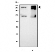 Maltase-glucoamylase Antibody Small Intestine WB. Western blot analysis of rat and mouse small intestine tissue lysates using Maltase-glucoamylase Antibody / MGAM Antibody. Lane 1: rat small intestine; Lane 2: mouse small intestine. Bands are detected in the expected high molecular weight range, consistent with MGAM isoforms predicted at approximately 210 kDa and 312 kDa. Higher molecular weight migration may occur due to glycosylation of this intestinal brush border enzyme. These results support the use of Maltase-glucoamylase Antibody / MGAM Antibody for studying carbohydrate digestion enzymes and gastrointestinal metabolism pathways.